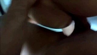 my wife had an accident and needed stitches